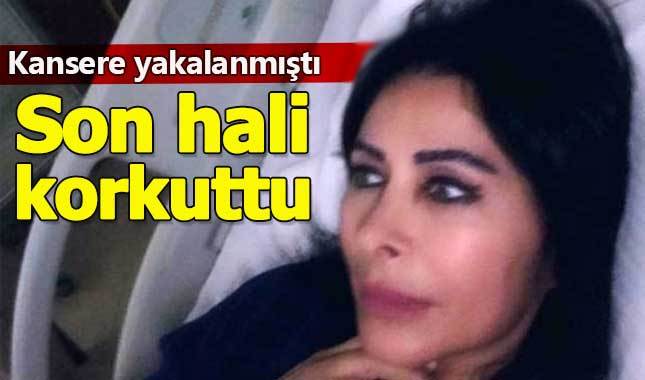 Nuray Hafiftaş'ın son hali sevenlerini korkuttu