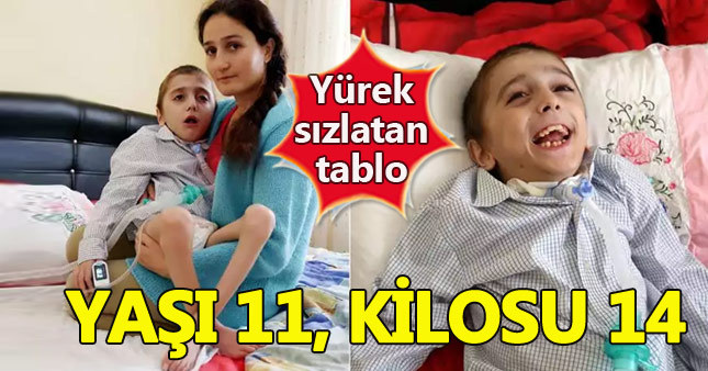 11 yaşındaki Cihangir günden güne eriyor