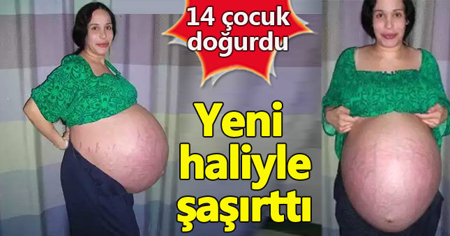 14 kez doğum yaptı, bu hale geldi