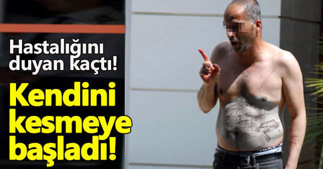 AIDS olduğu için hastaneye alınmadı kendini doğradı