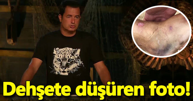 Acun Ilıcalı paylaştı gören dehşete kapıldı