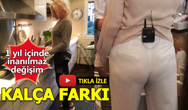 Ajda Pekkan'ın kalçasında bir yılda şaşırtan değişim!
