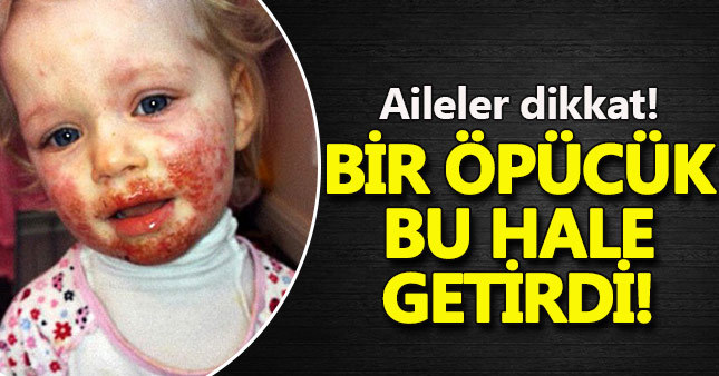 Akrabası öptü bu hale geldi