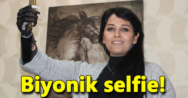 Biyonik koluyla yaşama tutundu