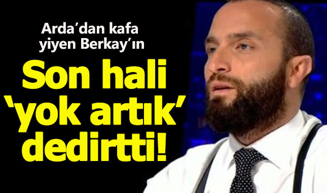 Burnu kırılan Berkay'ın son hali görüntülendi