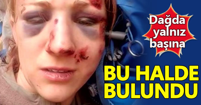 Dağ gezintisi az daha hayatına mal oluyordu!