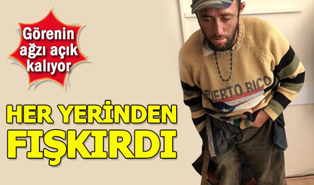 Dilencinin üzerinden çıkanlar görenleri şaşkına çevirdi