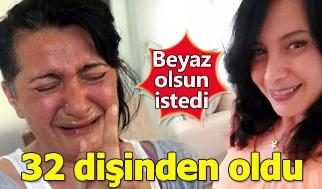 Diş beyazlatmak isterken 32 dişinden oldu | Delirten hastalık trigeminal nevralji nedir?