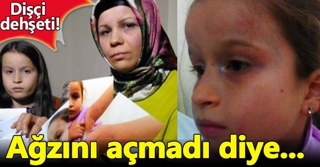 Dişçiden 8 yaşındaki İrem'e darp!