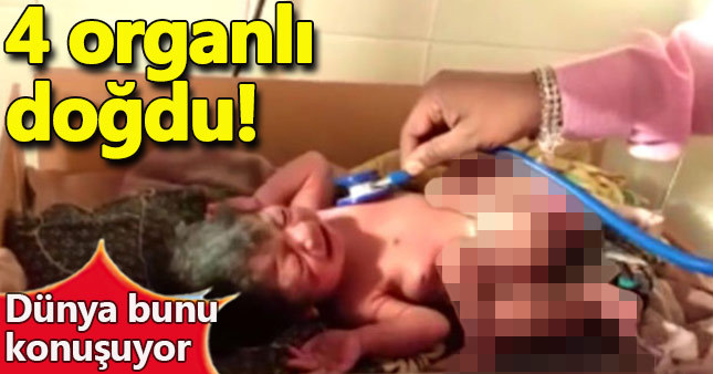 Dört bacaklı, iki penisli bebek doğdu!