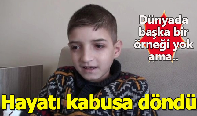 Dünyada bir ilk oldu ama hayatı kabusa döndü!