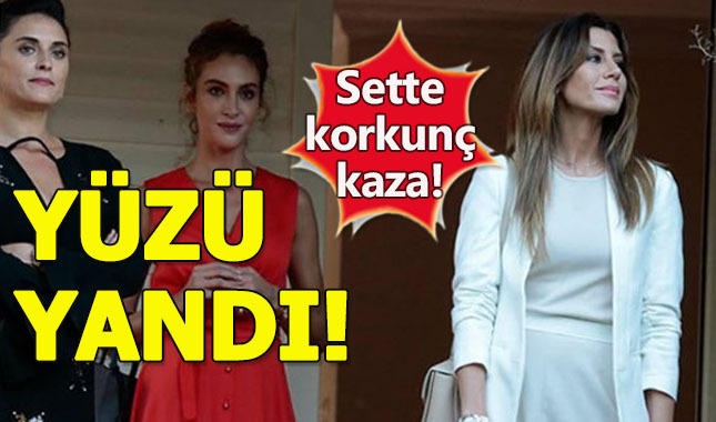 Duygu Sarışın'ın sette yüzü yandı