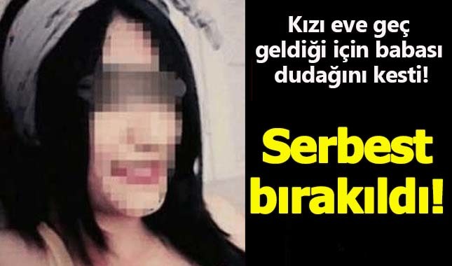 Edirne'de kızı eve geç geldiği için babası dudağını kesti! Serbest bırakıldı!