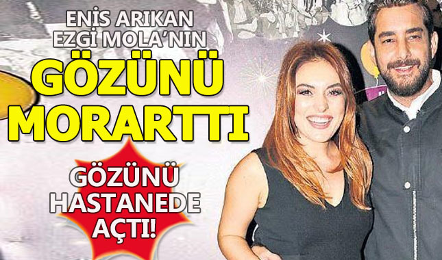 Enis Arıkan, yanlışlıkla Ezgi Mola'nın gözüne vurdu