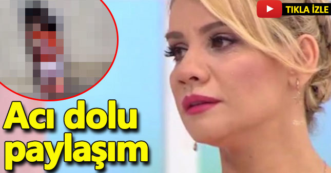 Esra Erol'dan yürek yakan paylaşım