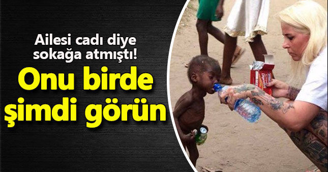 Fotoğrafıyla yürek burkan çocuğun son hali
