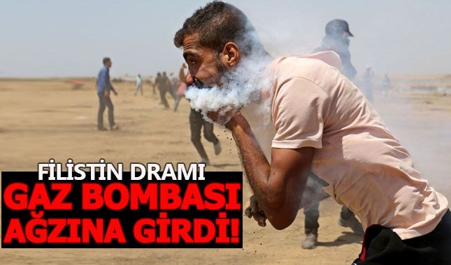 Gaz bombası Filistinli göstericiyi ağzından yaraladı