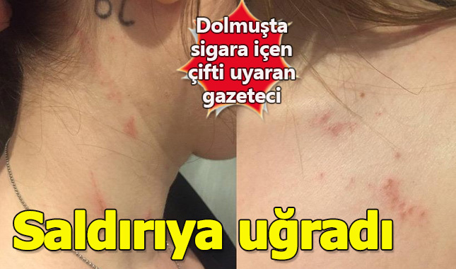 Gazeteci Nil Dumansızoğlu dolmuşta saldırıya uğradı