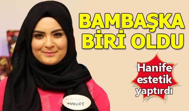 Gelin adayı Hanife'nin estetikli hali görenleri şaşkına çeviriyor