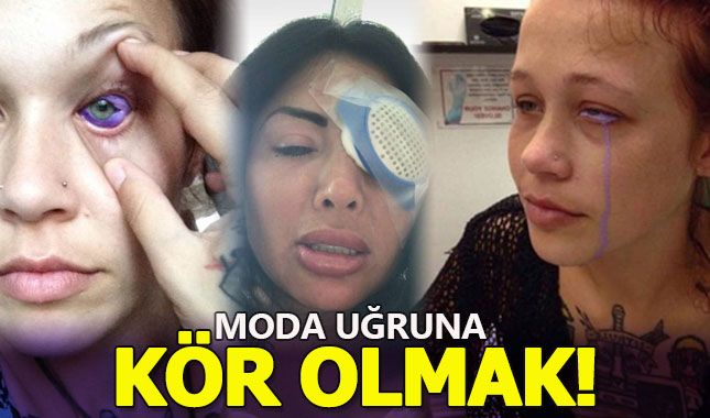 Göz renklerini değiştirmek için kör kalmayı göze alan güzeller!