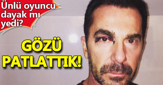 İlker İnanoğlu: Gözü patlattık
