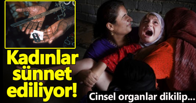 Kadın sünneti nedir, nasıl yapılır?