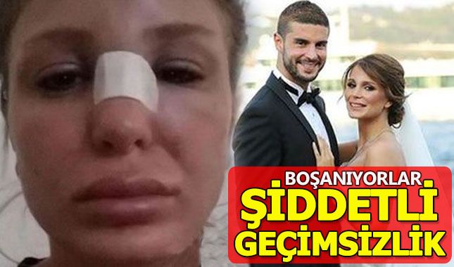 Merve Şarapçıoğlu ve Berk Oktay boşanıyor