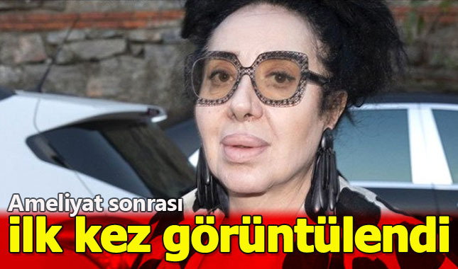 Nur Yerlitaş Ameliyatının ardından ilk defa görüntülendi