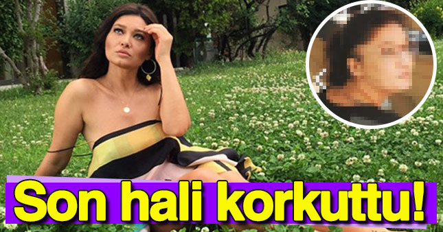 Nurgül Yeşilçay'ın son hali hayranlarını korkuttu