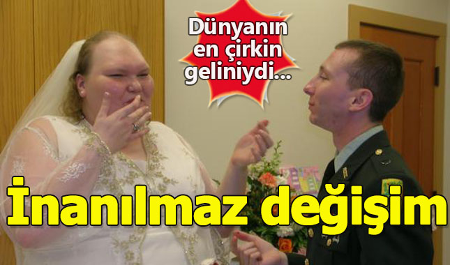 Ona dünyanın en çirkin gelini demişlerdi! Şimdiki hali şaşırttı!