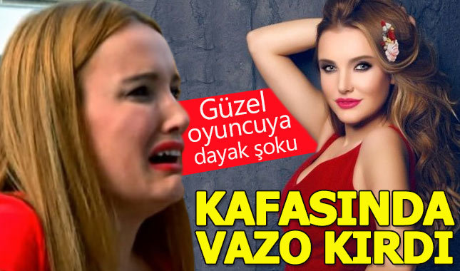 Oyuncu Meral Kaplan, bakıcısından dayak yedi (Meral Kaplan kimdir?)