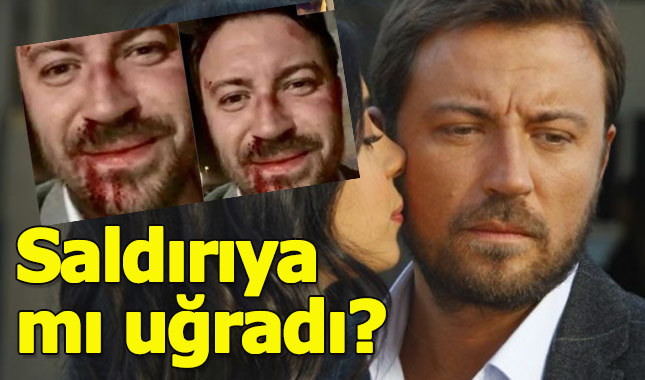 Oyuncu Tolga Güleç saldırıya mı uğradı kimdir kaç yaşında nerelidir?
