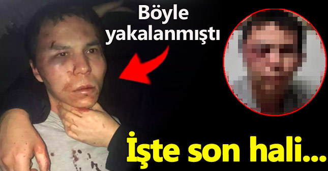 Reina saldırganı tanınmaz hale geldi