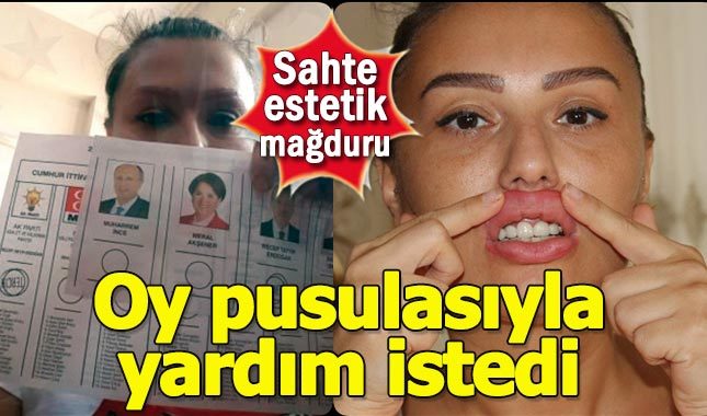 Sahte estetik mağduru, oy pusulasıyla hükümetten yardım istedi