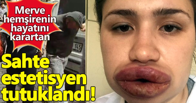 Sahte 'estetik uzmanı' kıskıvrak yakalandı