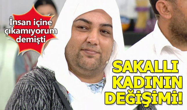 Zahide Yetiş sakallı kadının yeni hali görenleri hayrete düşürdü!