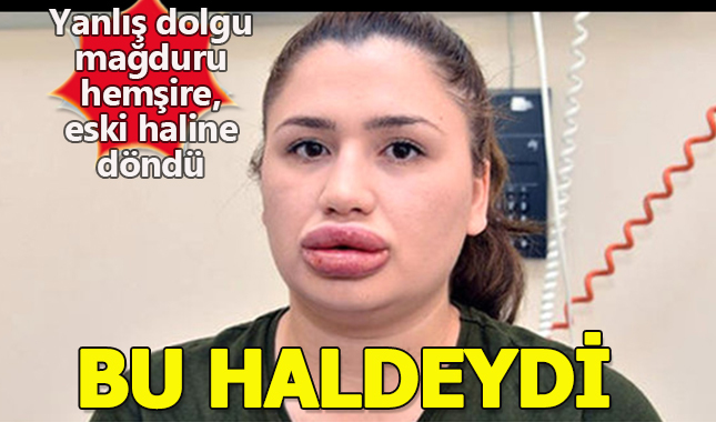 Silikon mağduru Merve hemşire, dudaklarını ameliyatla düzeltti!