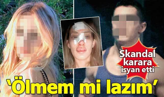 Skandal karar! Burun kıran sevgili serbest bırakıldı