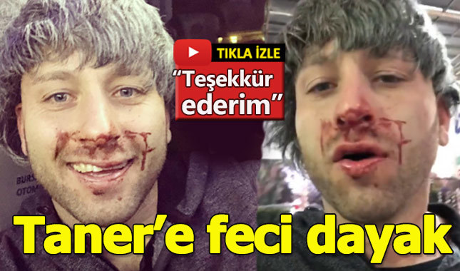 Survivor Taner'in ağzını burnunu dağıttılar