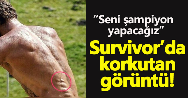 Survivor'da Adem'in şişen kemiği şok etti!