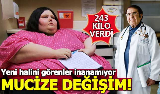 Tam 243 kilo verdi! Son haline kimse inanamıyor
