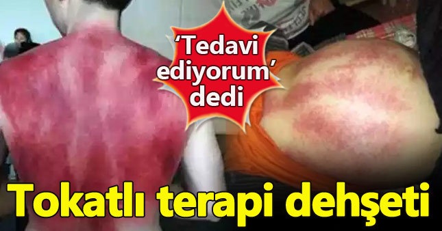 "Tokat terapisi" felaketle sonlandı