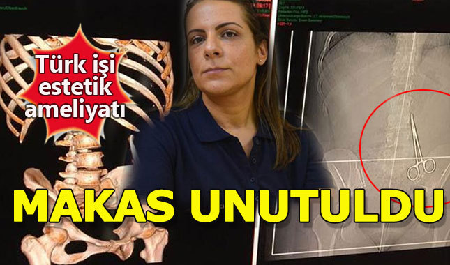 Türkiye'de estetik ameliyatı olan Alamancı'nın karnında makas unutuldu