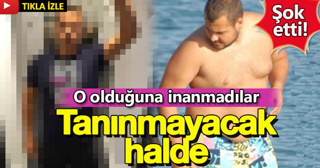 Ümit Erdim'in son hali şaşırttı