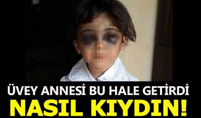Üvey annesi öldüresiye dövdü