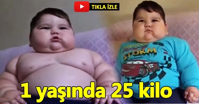 Yağız bebek yaşamak için zamanla yarışıyor