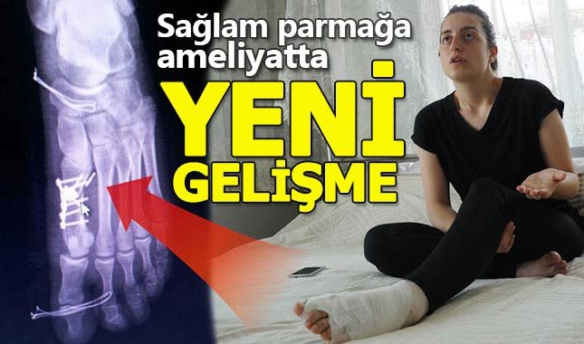 Yanlış parmağa ameliyat skandalında yeni gelişme
