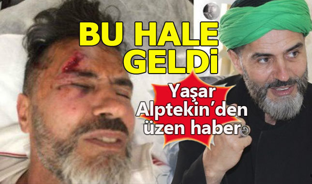 Yaşar Alptekin motor kazası geçirdi! Yaşar Alptekin kimdir?