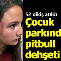 12 yaşındaki kıza pitbull saldırdı - Tekirdağ haberleri