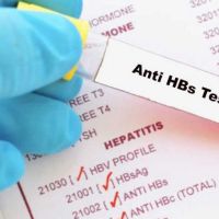 Anti hbs nedir | anti HBS testi neden yapılır | Negativ pozitif çıkması ne anlama gelir?